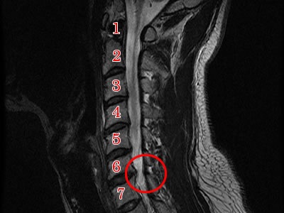 交通事故治療、むち打ち症、川崎、横浜、MRI