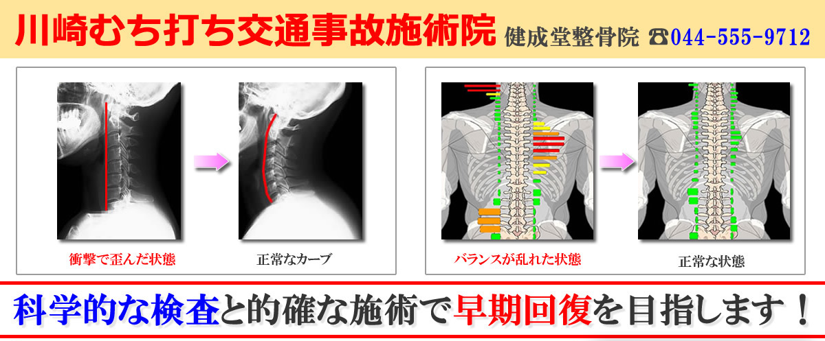 川崎むちうち交通事故治療院